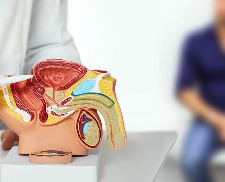 Aumentan casos de cáncer de próstata en el estado de Oaxaca