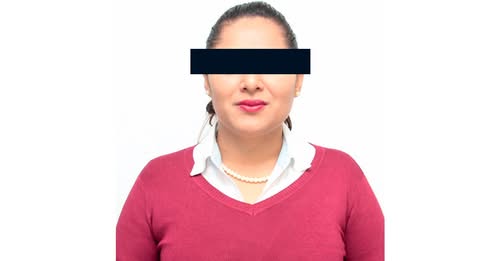 Ex síndica